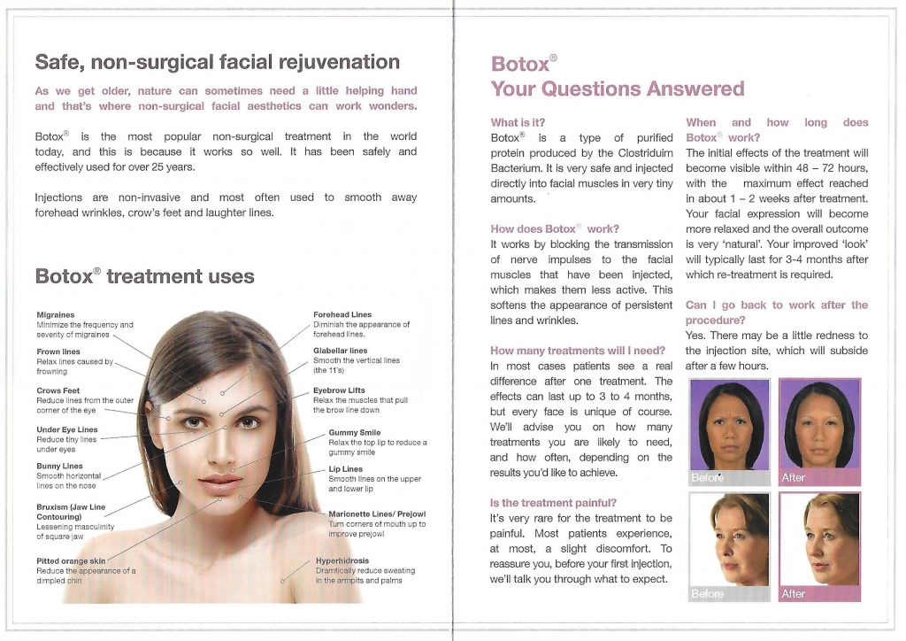 Facial Rejuvenation – Using Botox And Azzalure Crownwood Dental